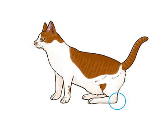 歩き方の異常について