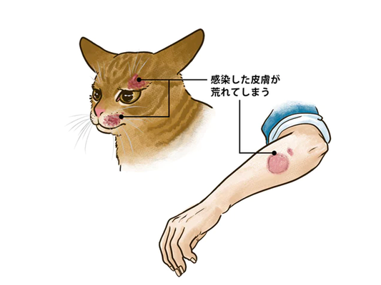 ねこから人に感染する病気